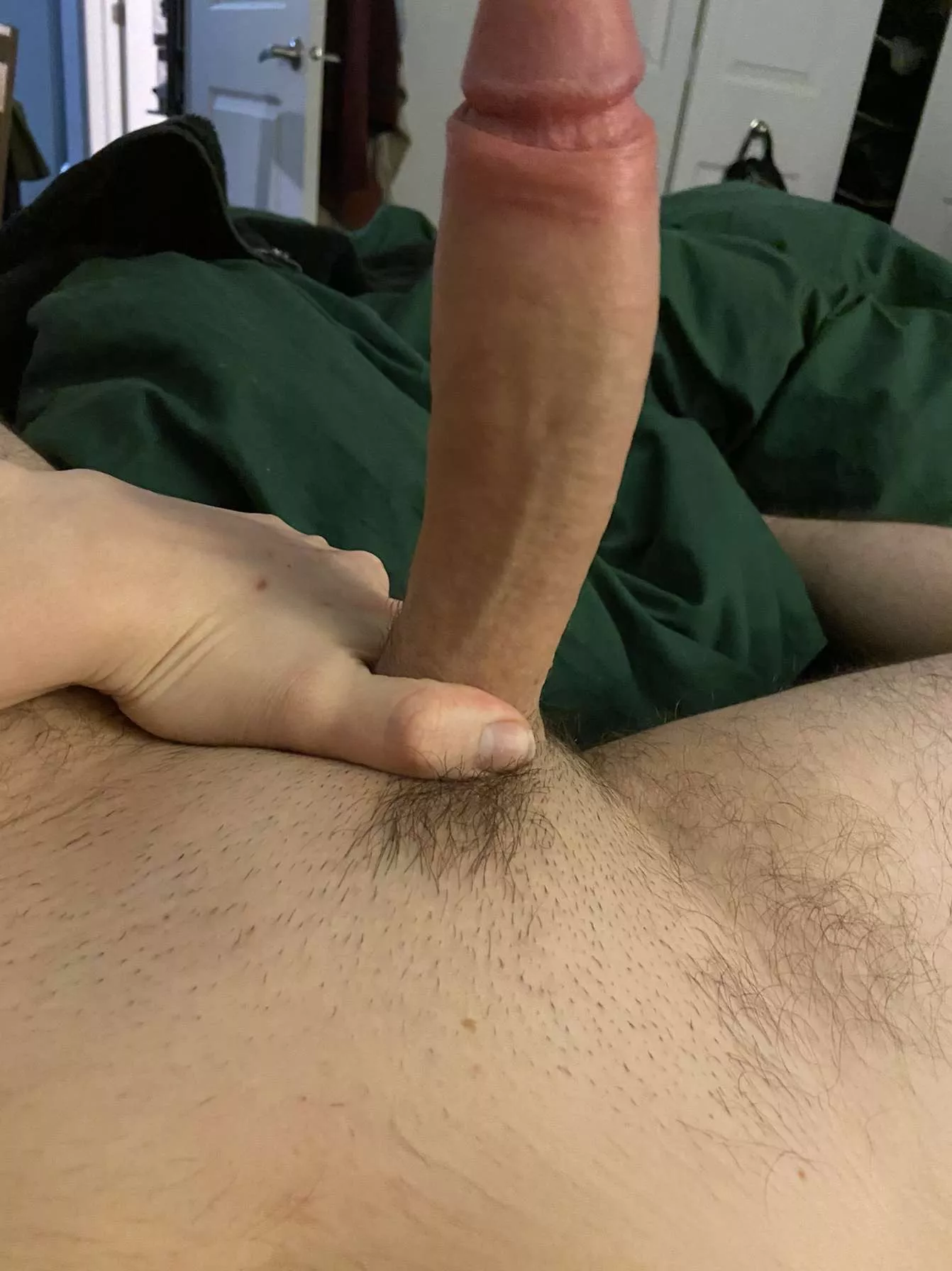 My Cock is too big for my Foreskin ðŸ˜…