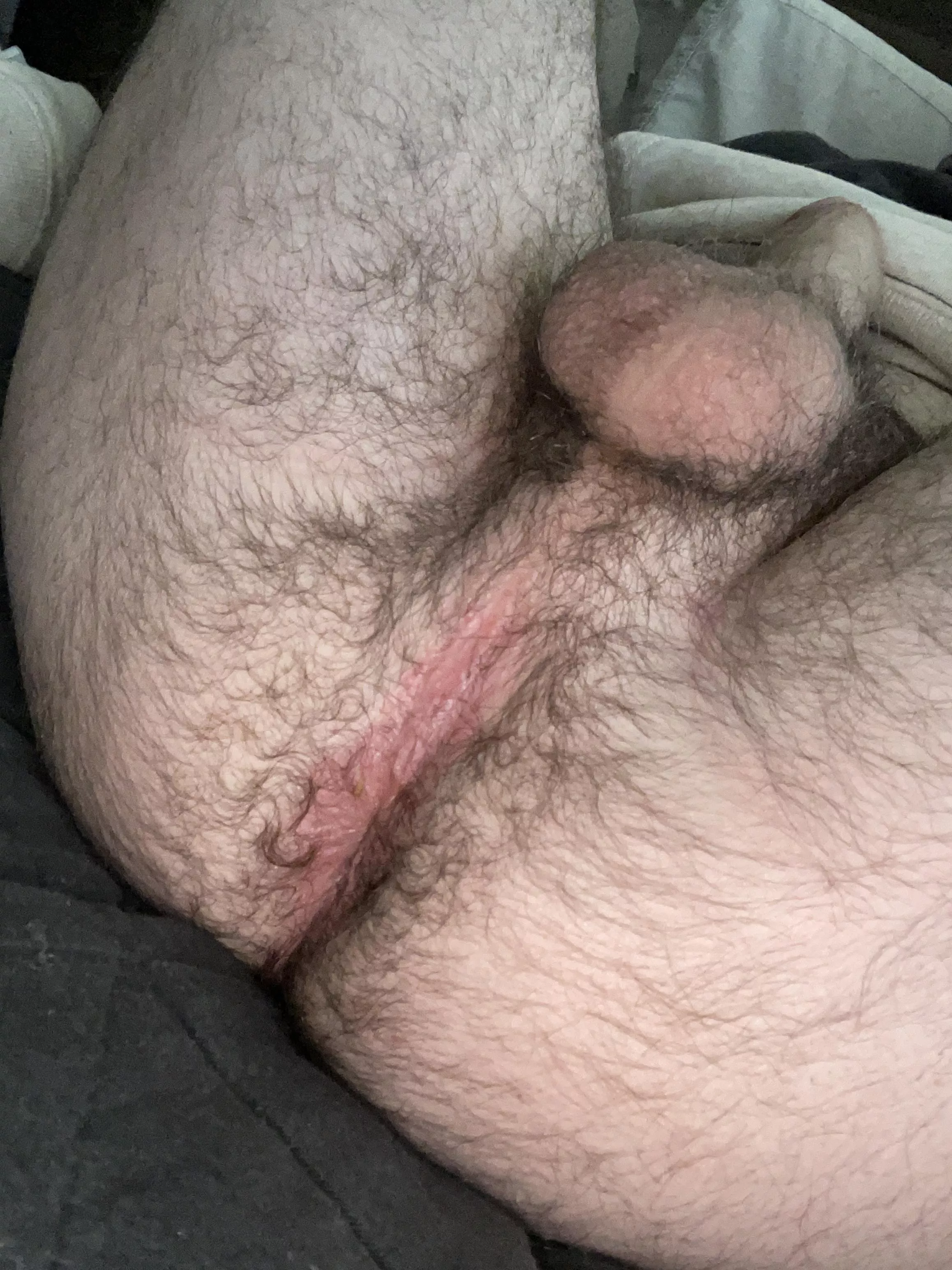 My hairy ass and balls. Anyone wanna taste?