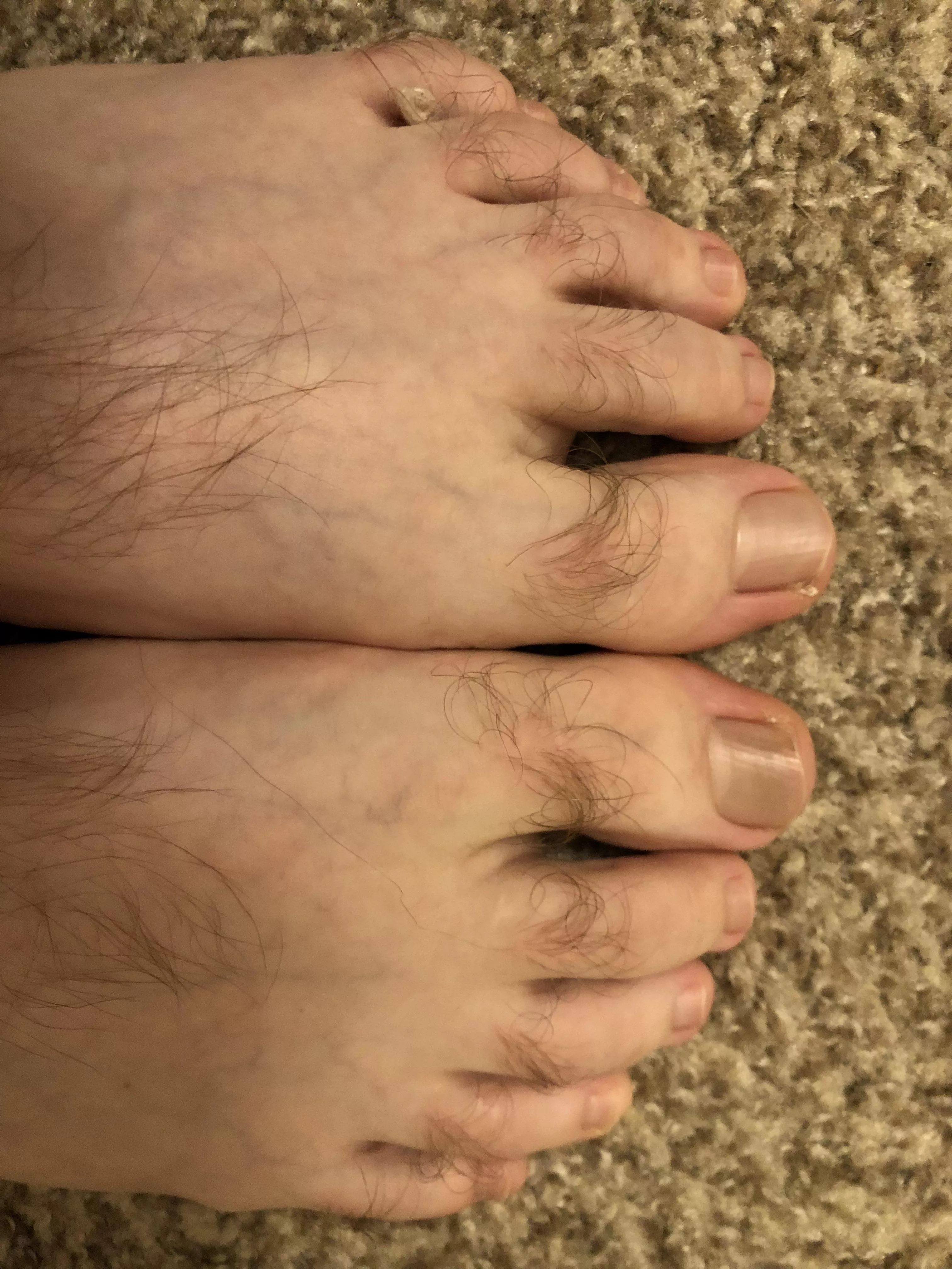 My hairy feet ðŸ¦¶