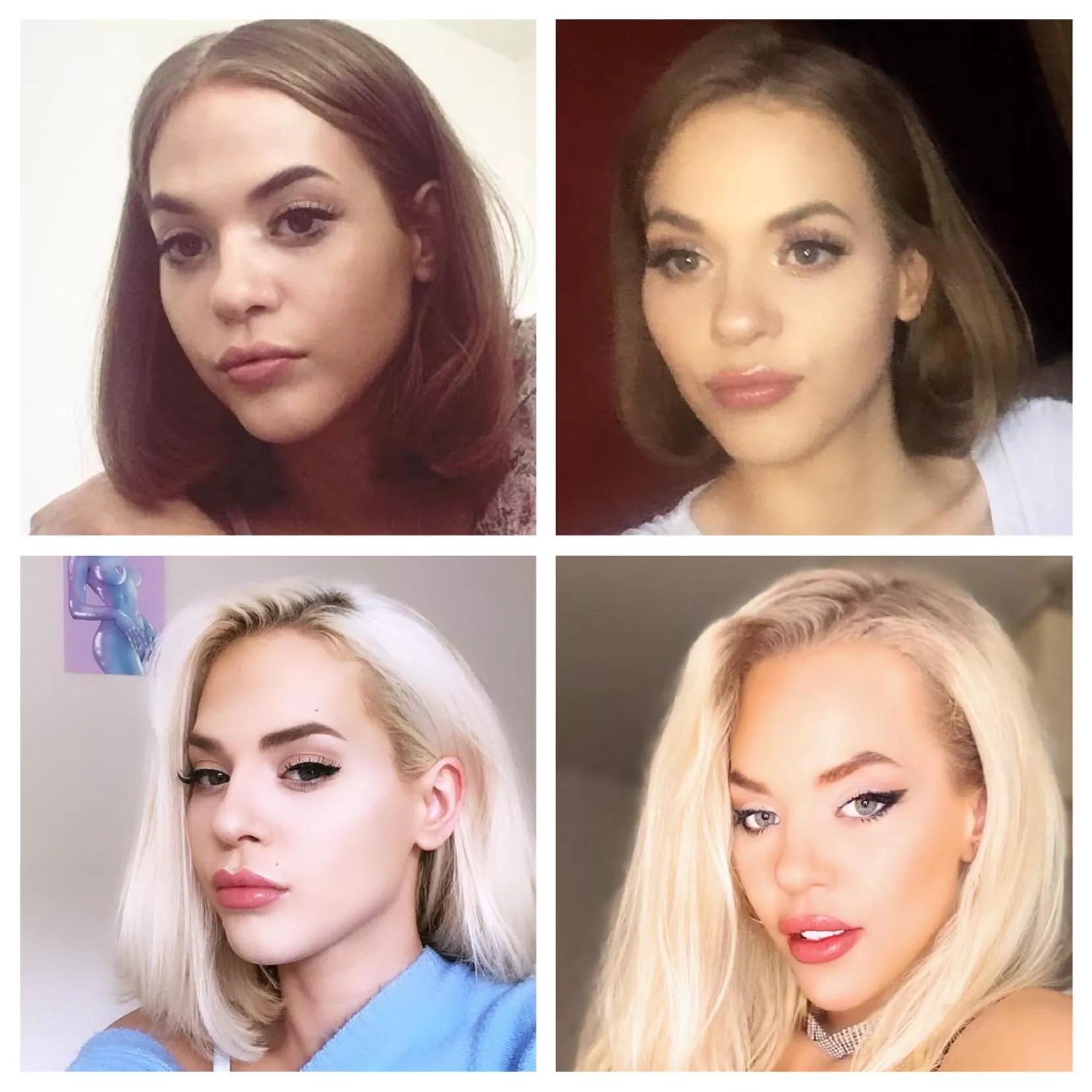 My journey so far ovre the past 3 years(please ignroe my quarantine roots) ; m trying to save for breast implants, a nose job & eyebrow thread lift. If you want to help me fund these, let me know, I want the surgeries as soon as I can and would be su