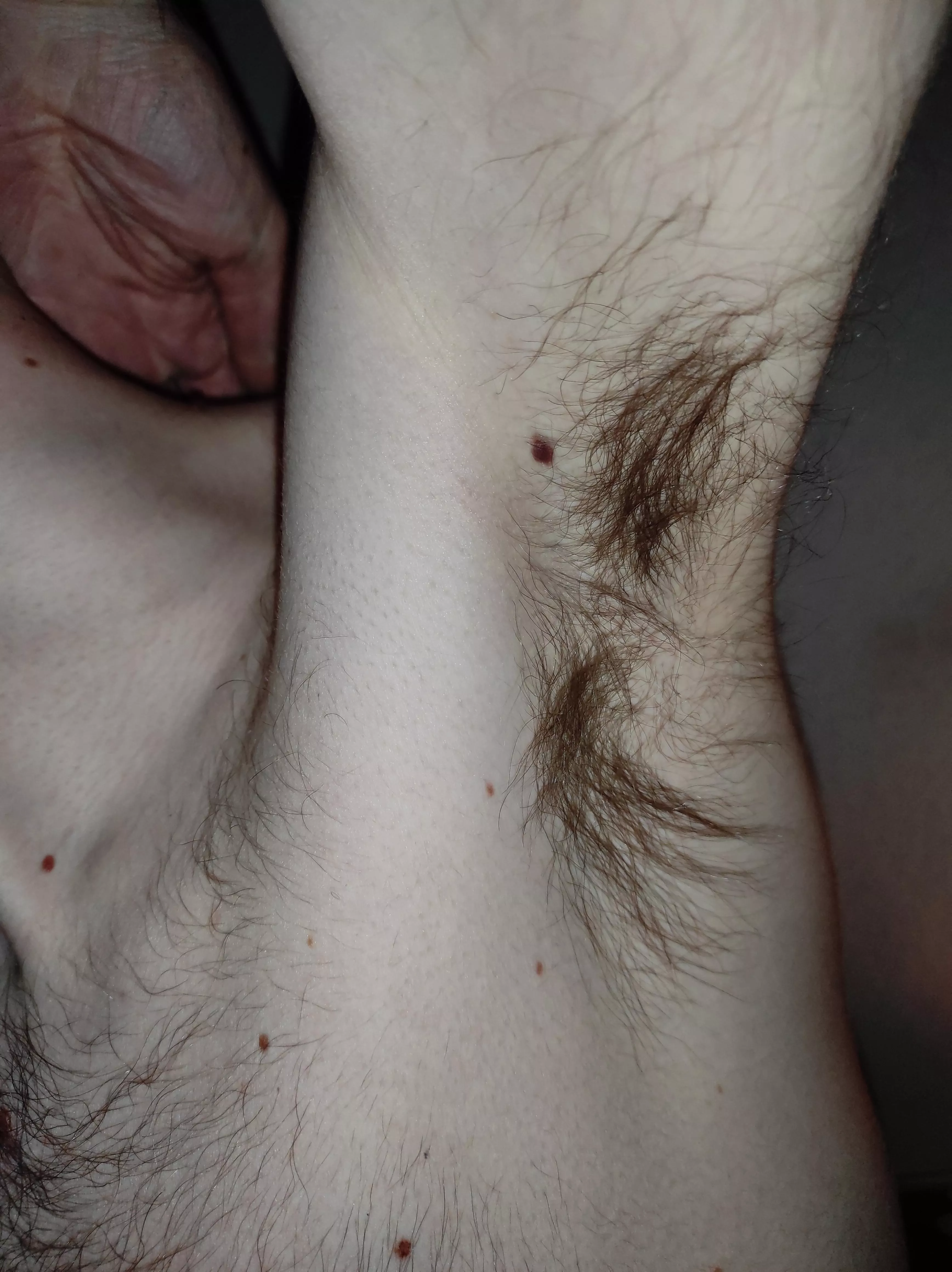 My pits are pretty hairy, aren't they?