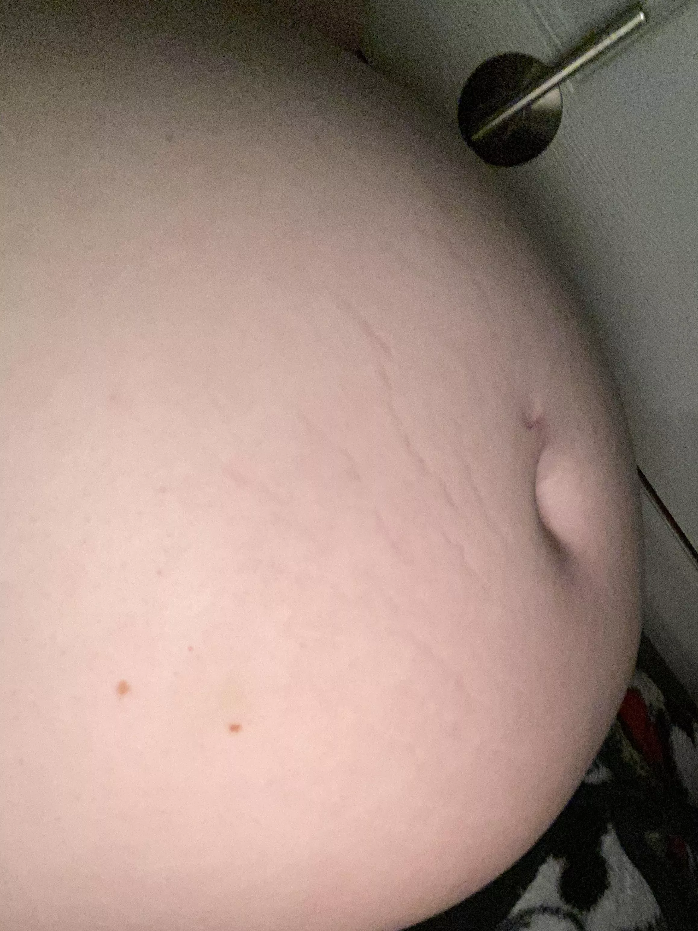 my stretch marks are finally coming in !