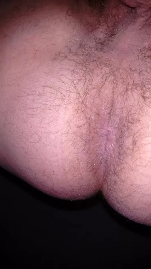 My taint (62) DM open