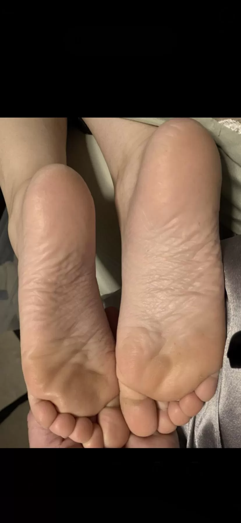 My wifeâ€™s wrinkly soles