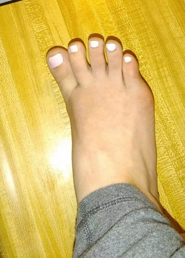 New toe color