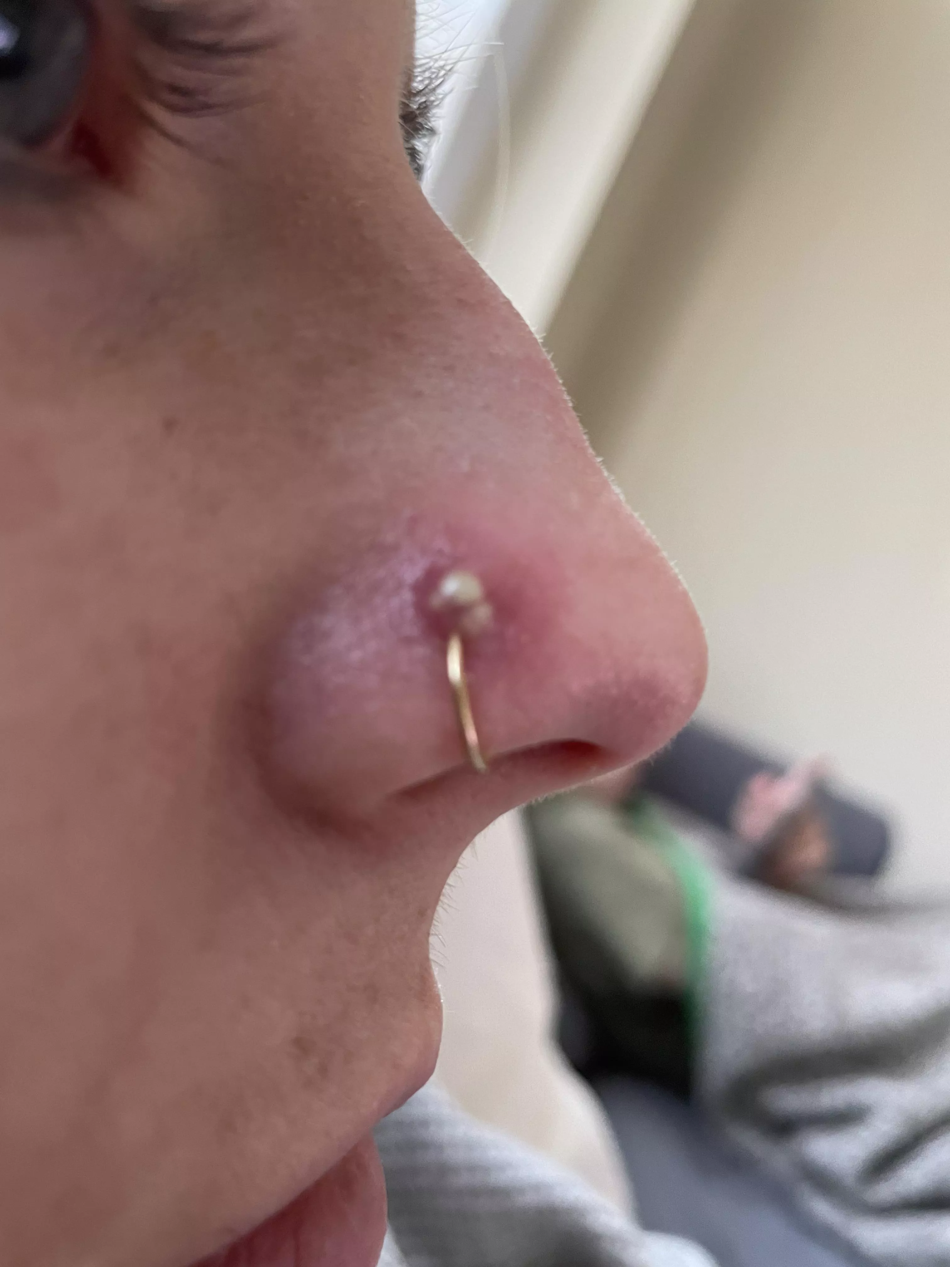 Nose ring pimple that needs to be popped. Will update later with video!