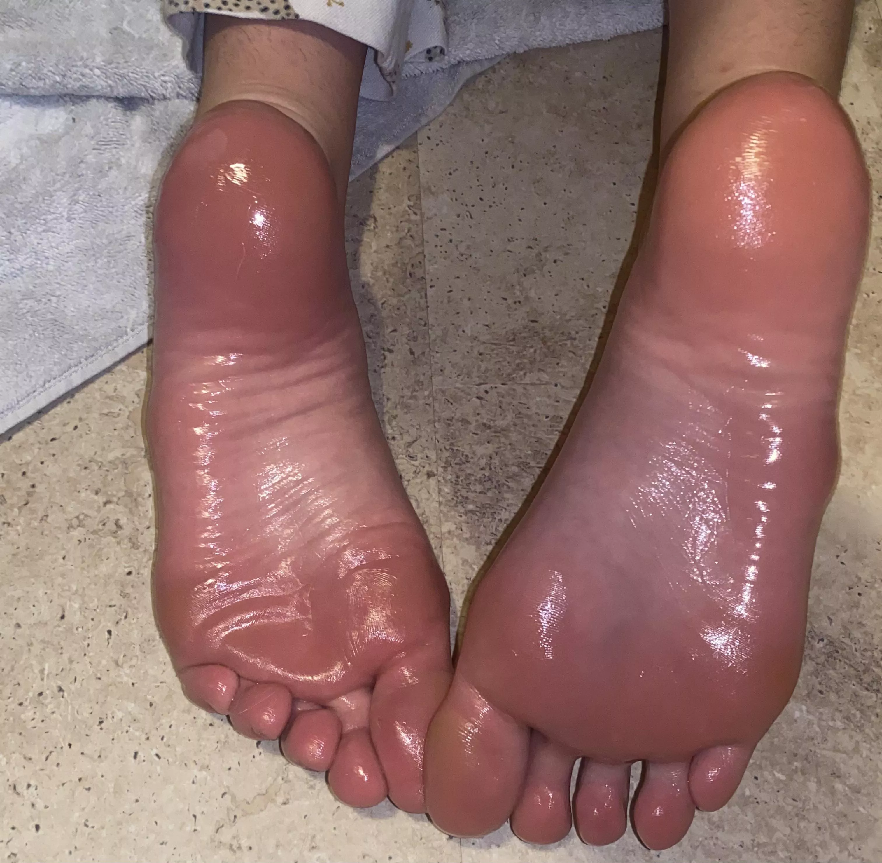 oily soles?