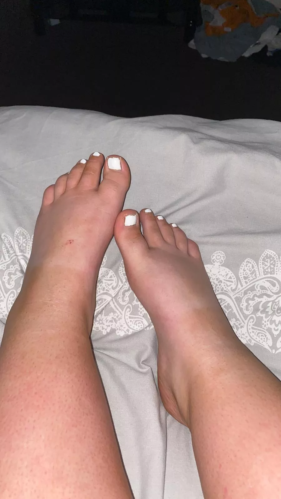 Old photo to ease myself in, who likes my white toes? Taking personal requests on my OF & SC, come have some fun, DMS open xx