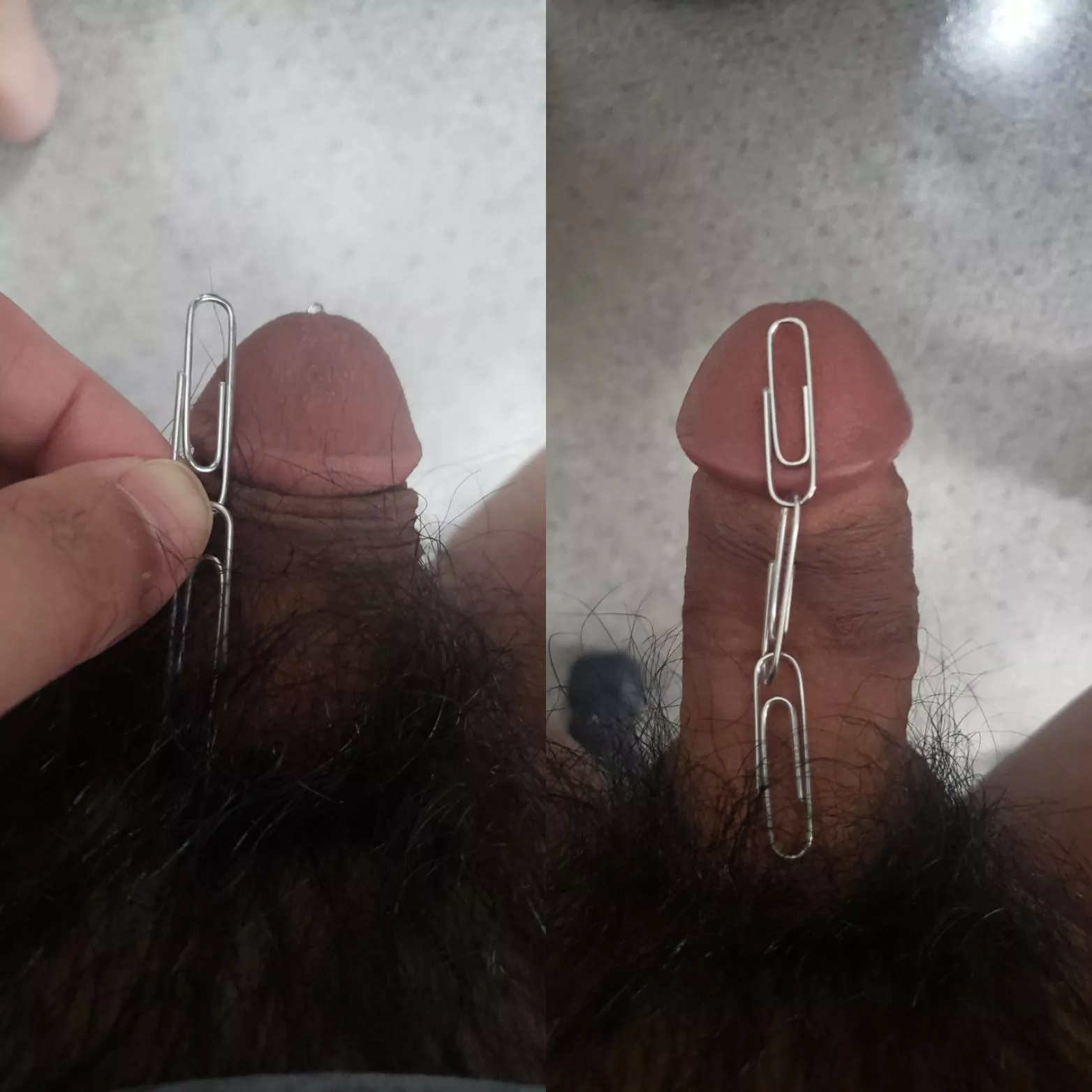 Paperclip clitty; soft vs hard [26]