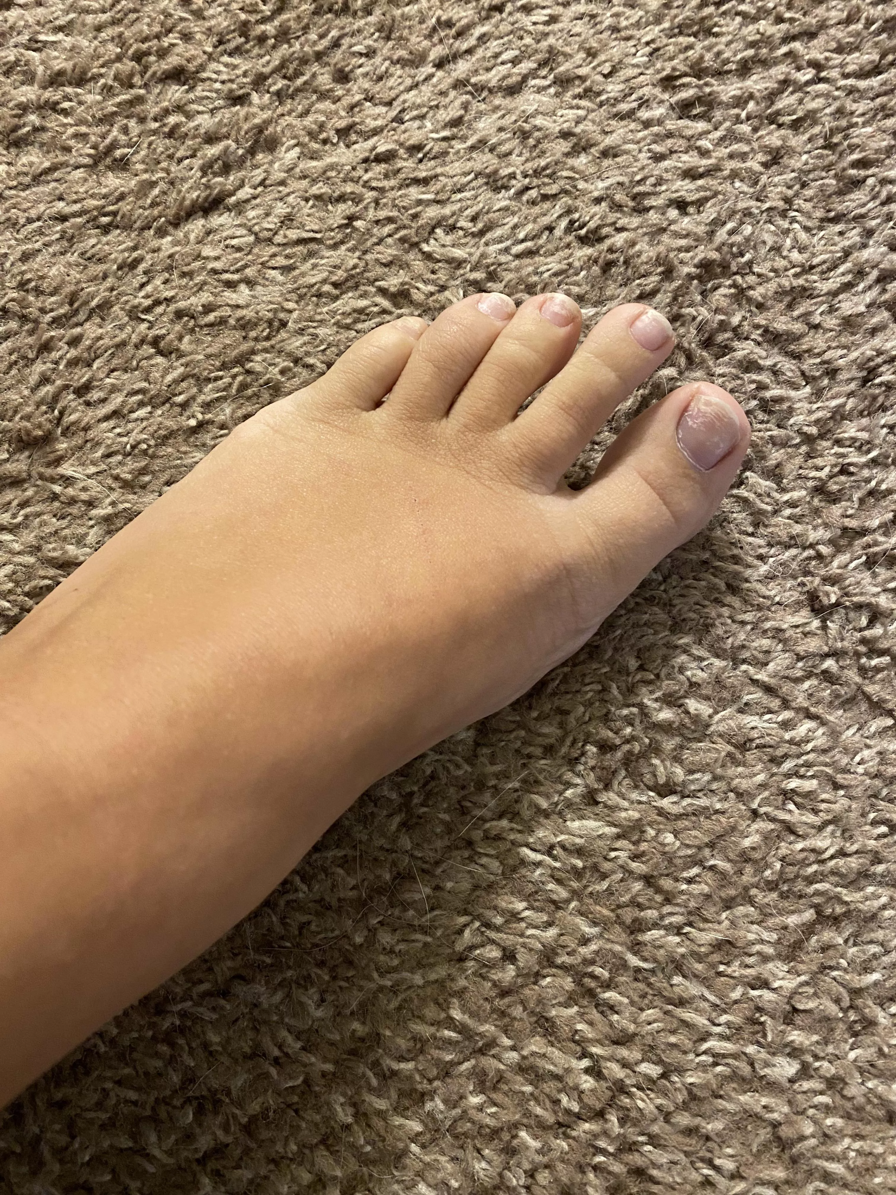 Please help my feet!