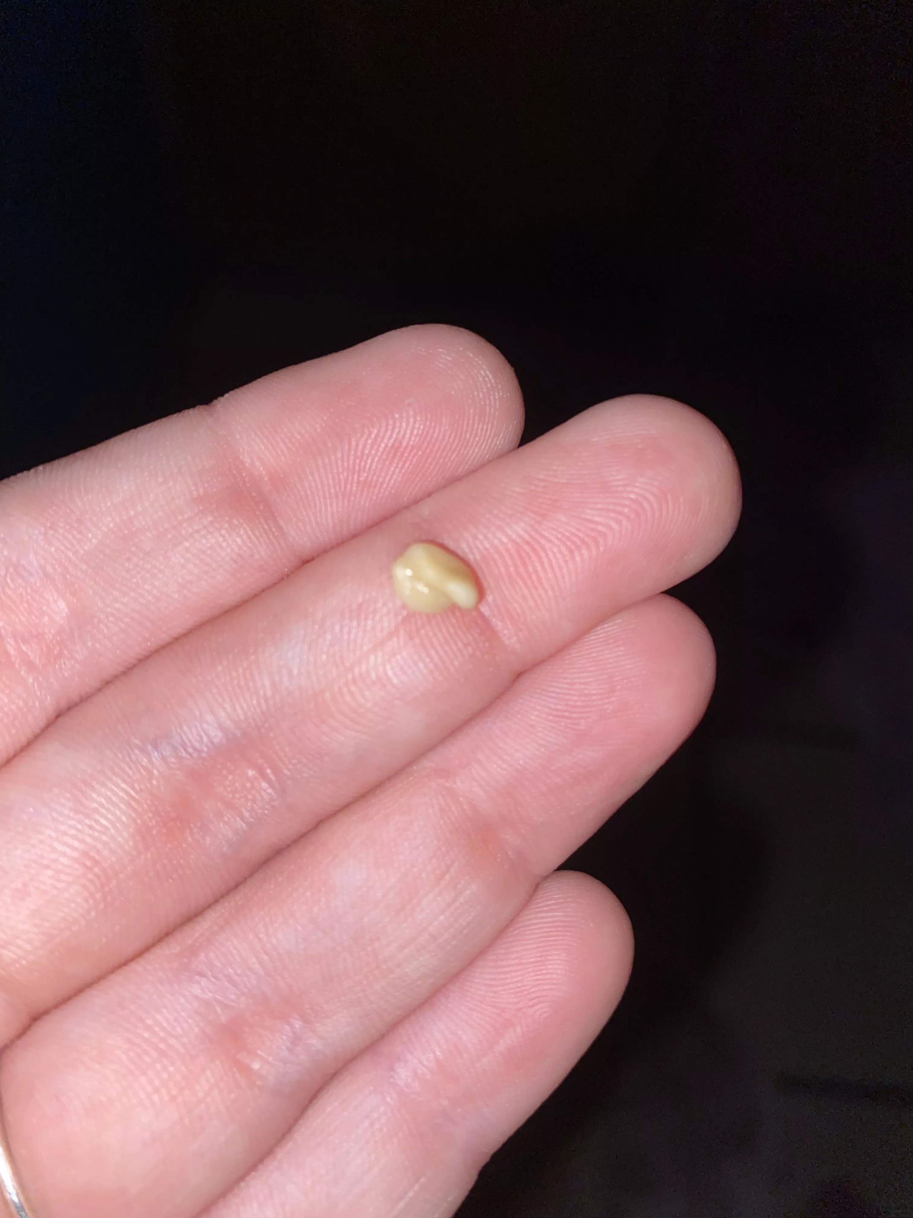 popped this out of my tonsil. i was so surprised!! the human body is crazy yall. i wish i got a video of it. my throat feels so much better