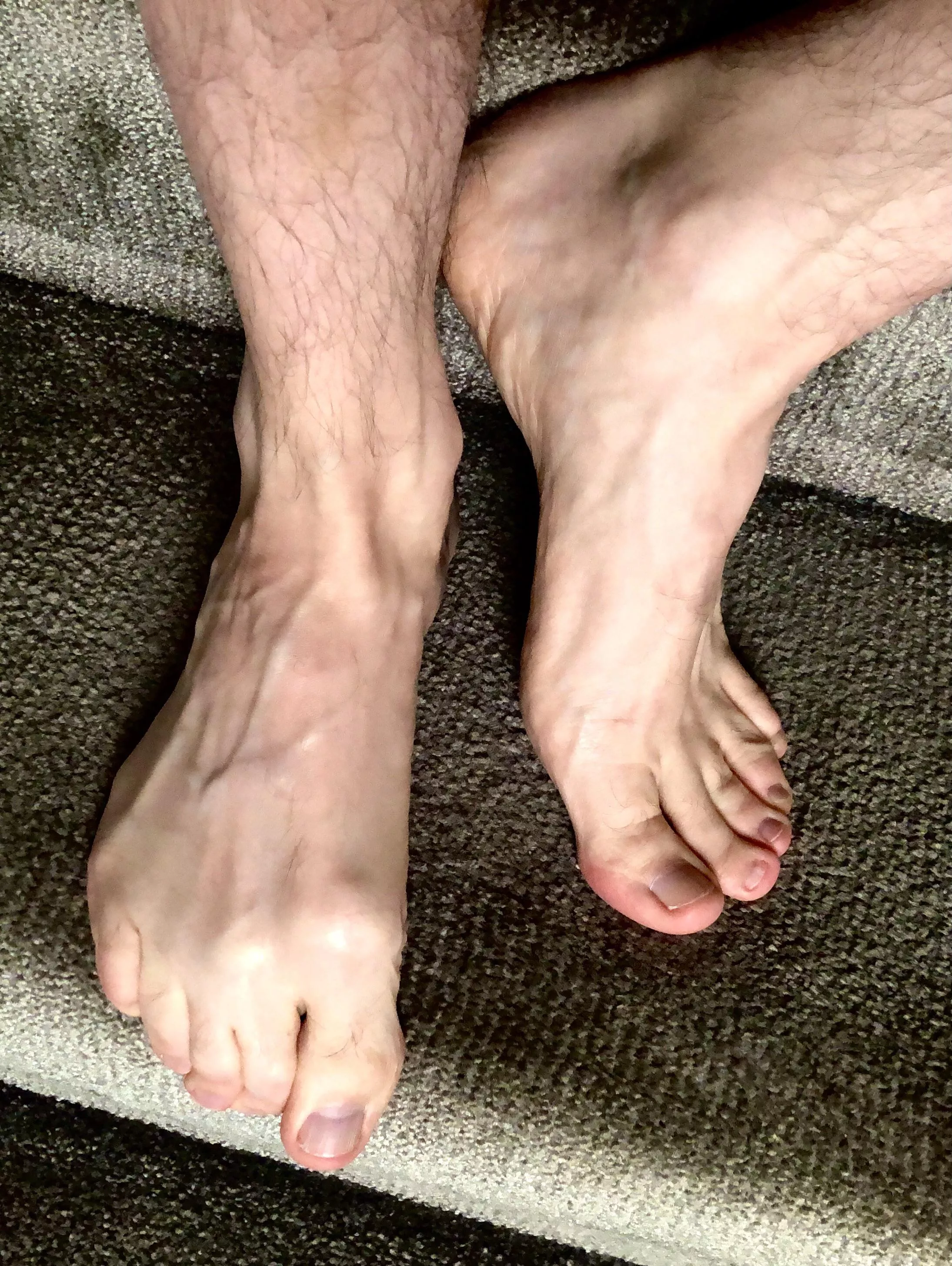 Post run, veiny feet