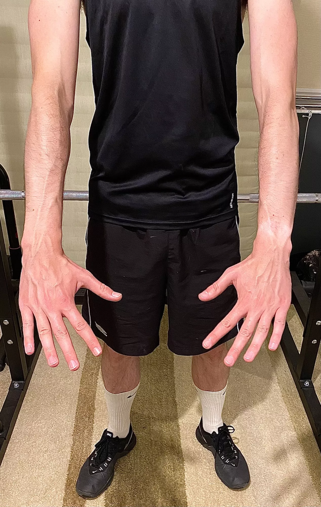 Post workout veins