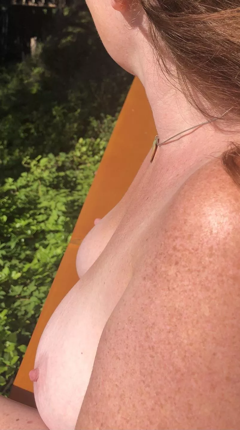 Redhead DDâ€™s freckles in the sun...