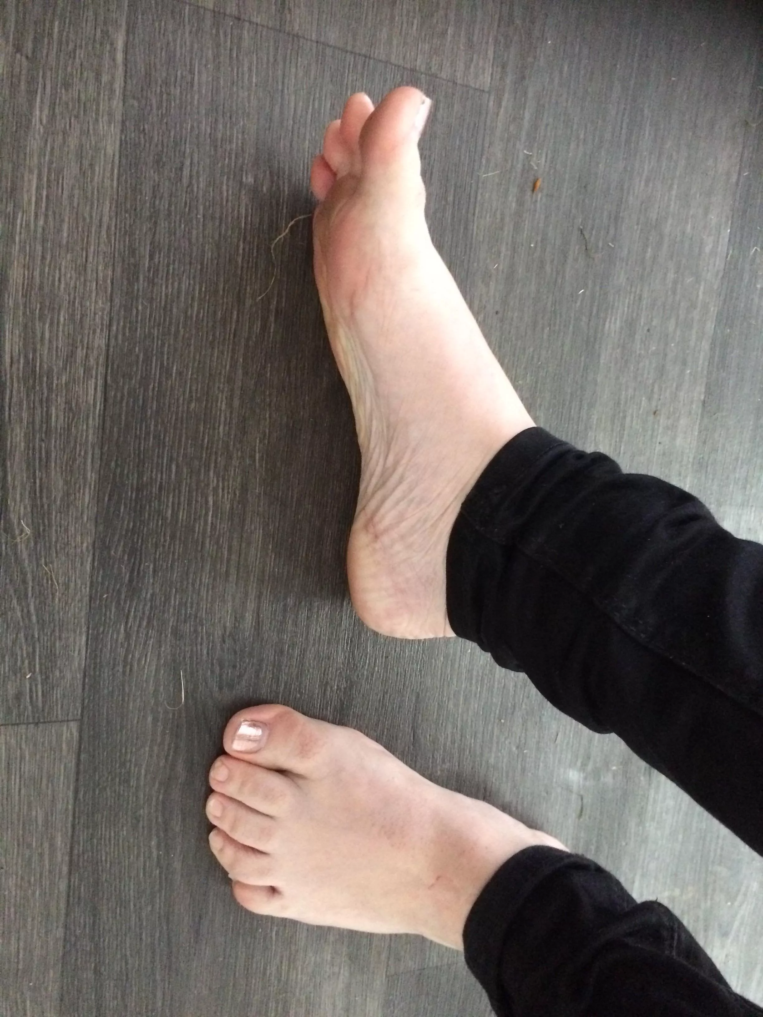 Requested pic, I think my toes are weird