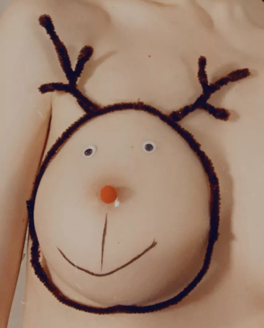 Rudolph the right boob