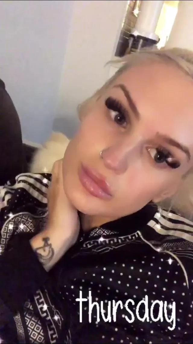 Sexy eyelashes + lip fillers