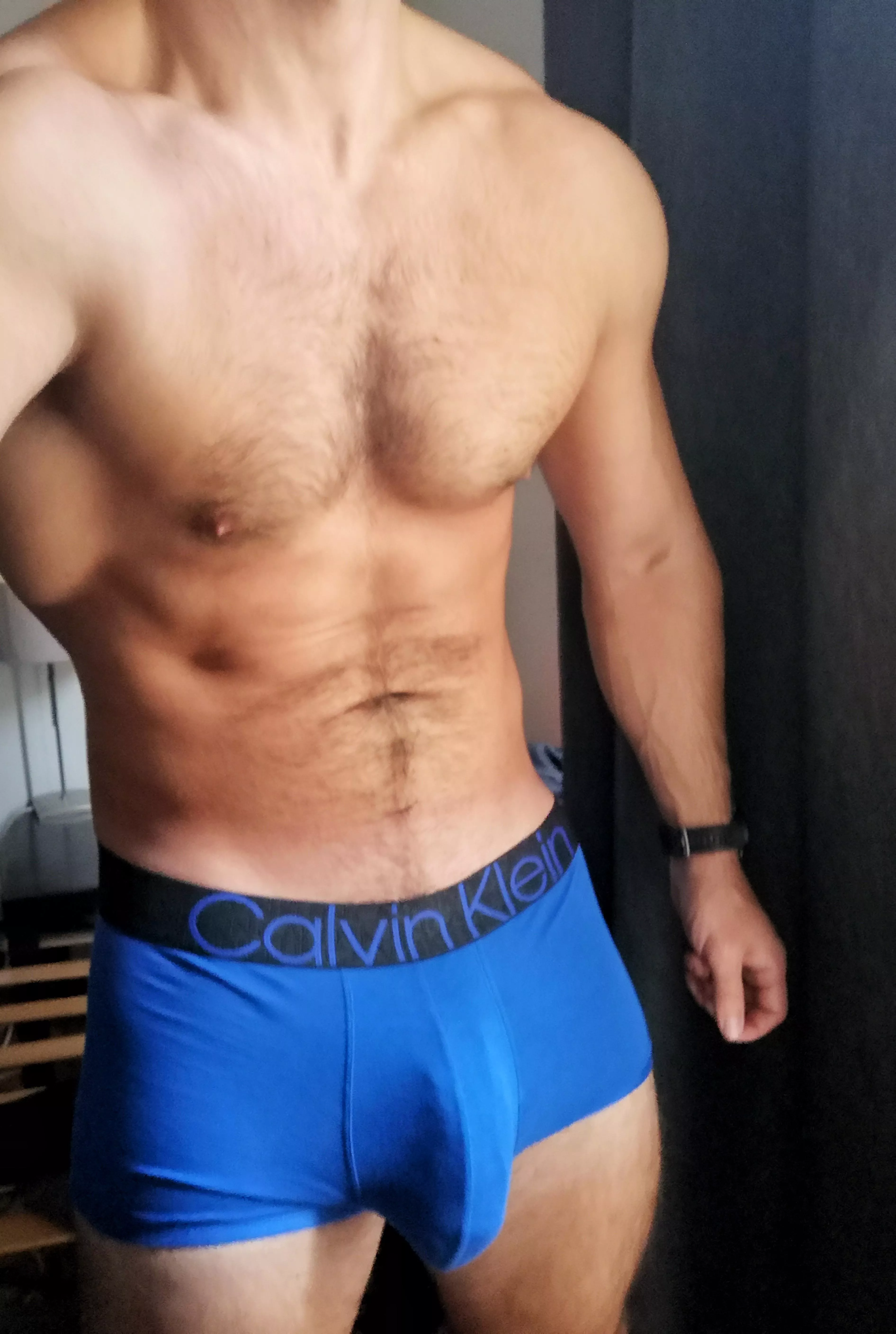 Soft bulge