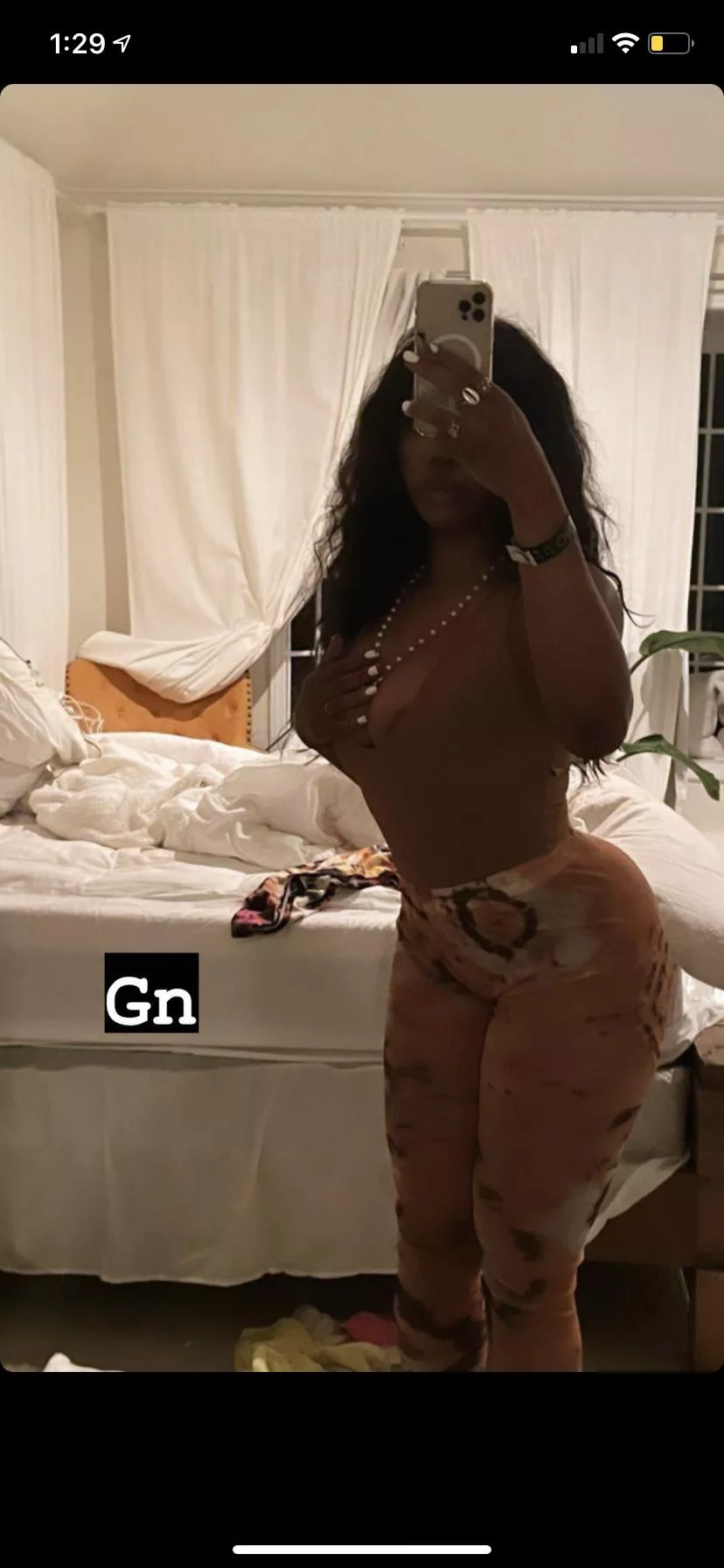 SZA Areola?