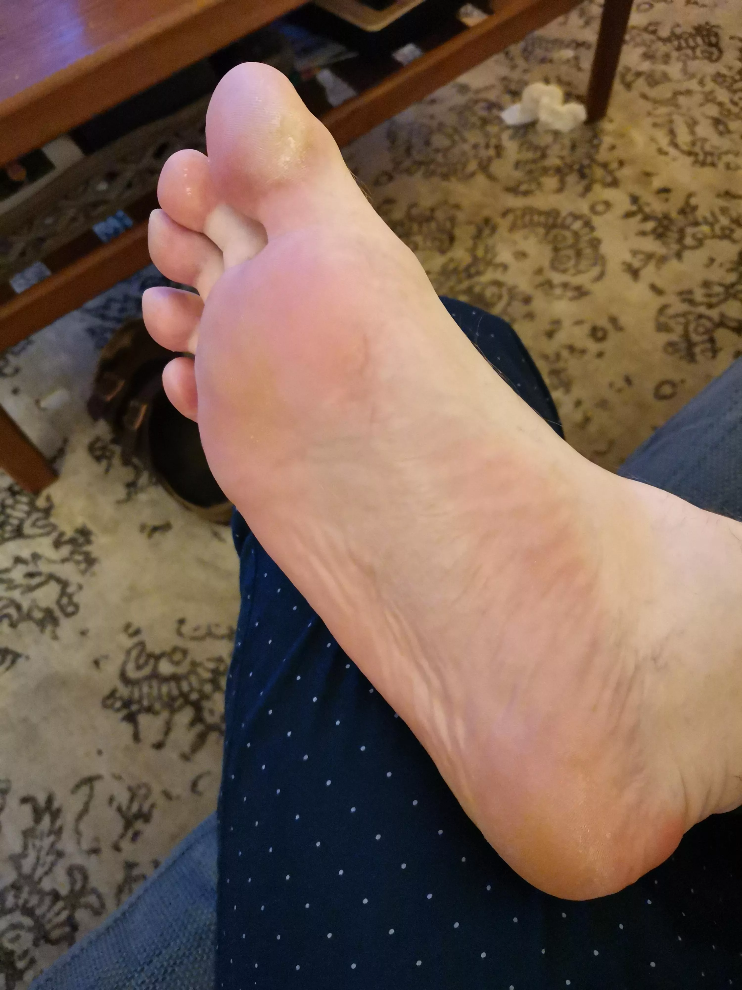 these tootsies sure could use some attention