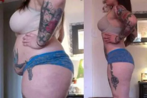 This is from a weight loss ad, but after studying it I'm convinced it's a weight gain, before and after: it's unlikely her underwear went from too tight to perfectly fitting.