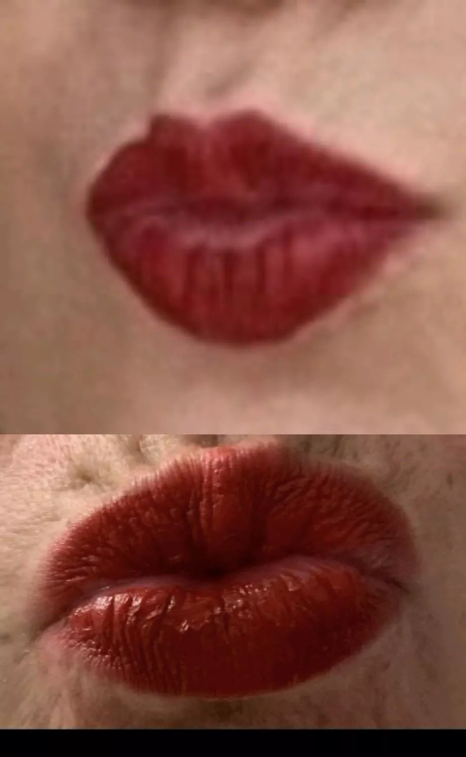 Top or bottoms lips?