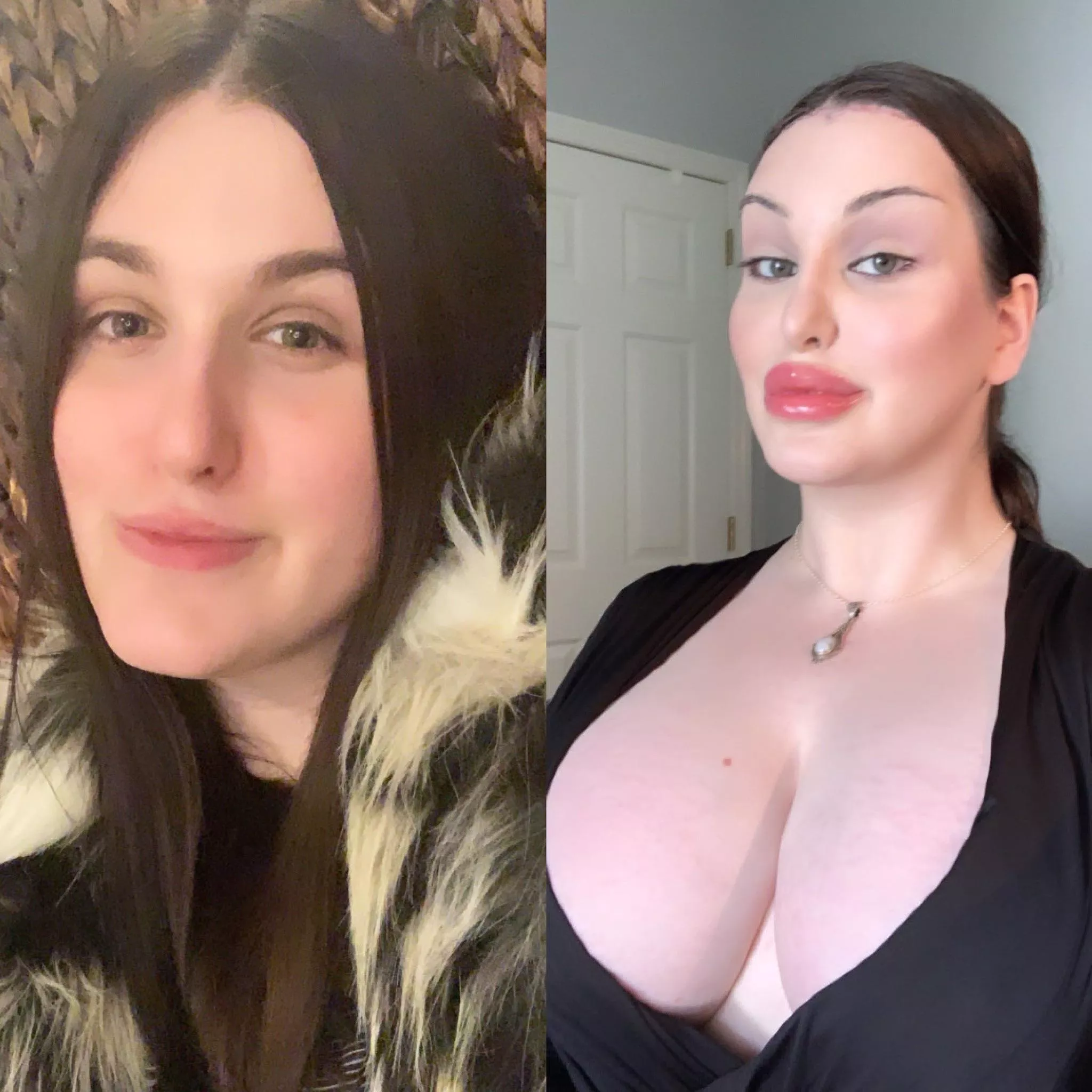 Trans Bimbo of The Year: 2020-2021 (Next Step 2,500cc+ Breast Expanders!)