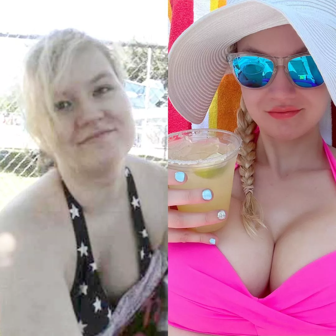 Weight loss, lip injections, boob job: My progress so far [OC]