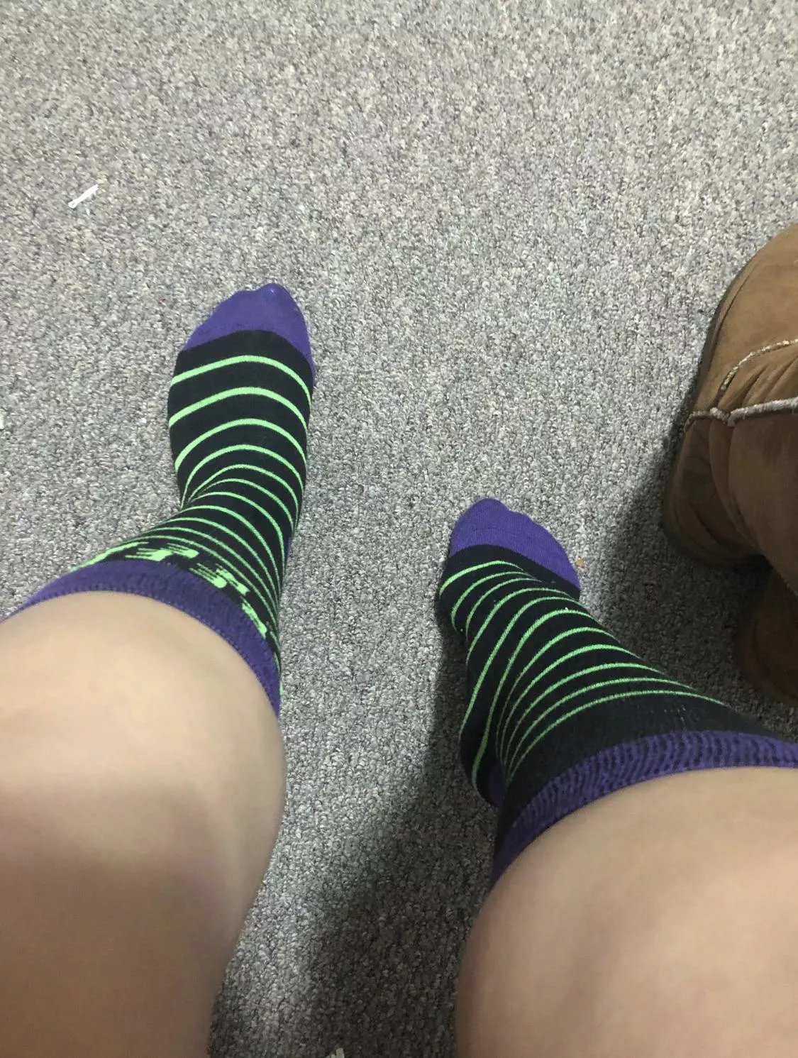 Who doesnâ€™t love striped socks?