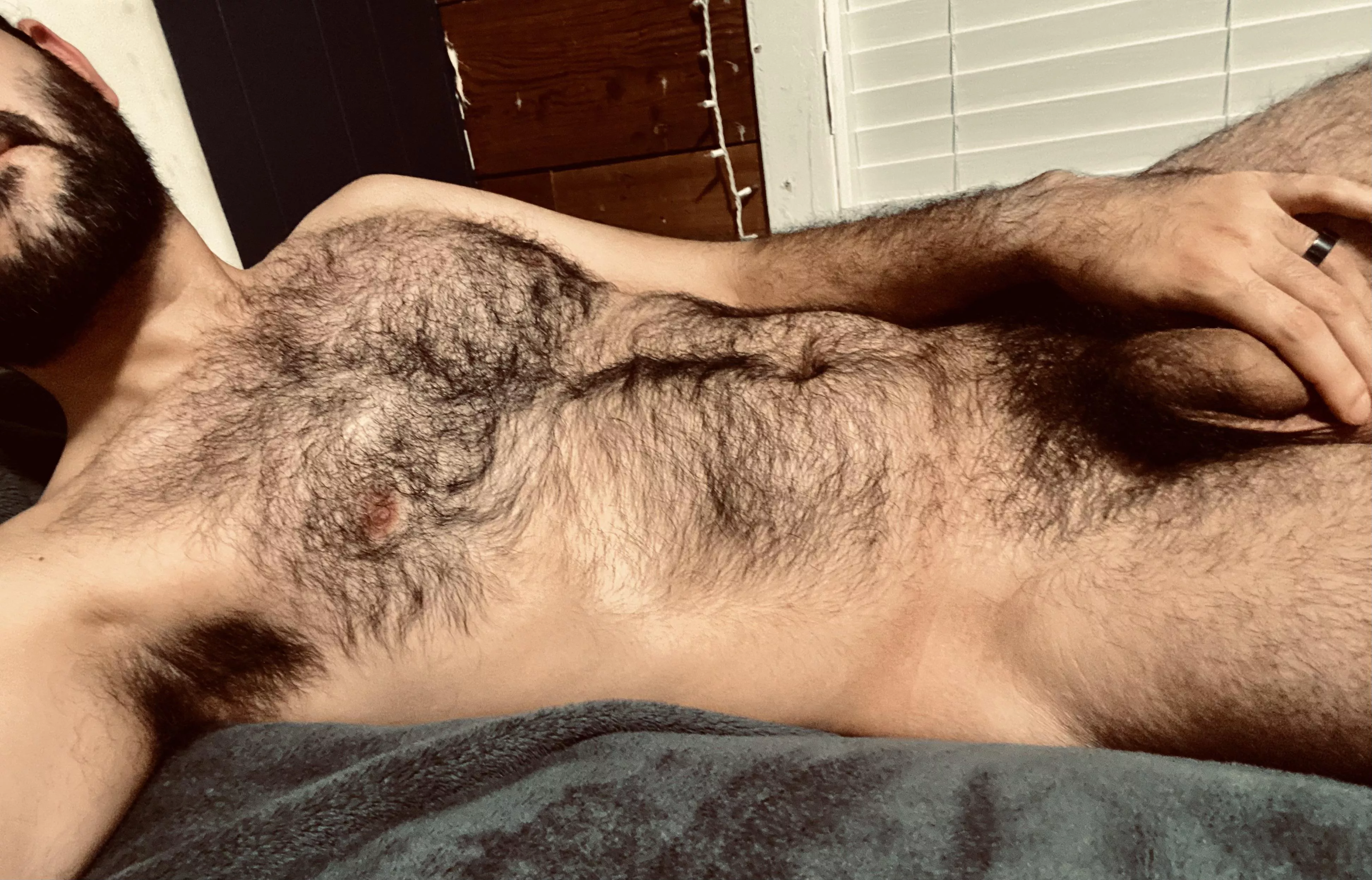 Who wants a hairy hug?