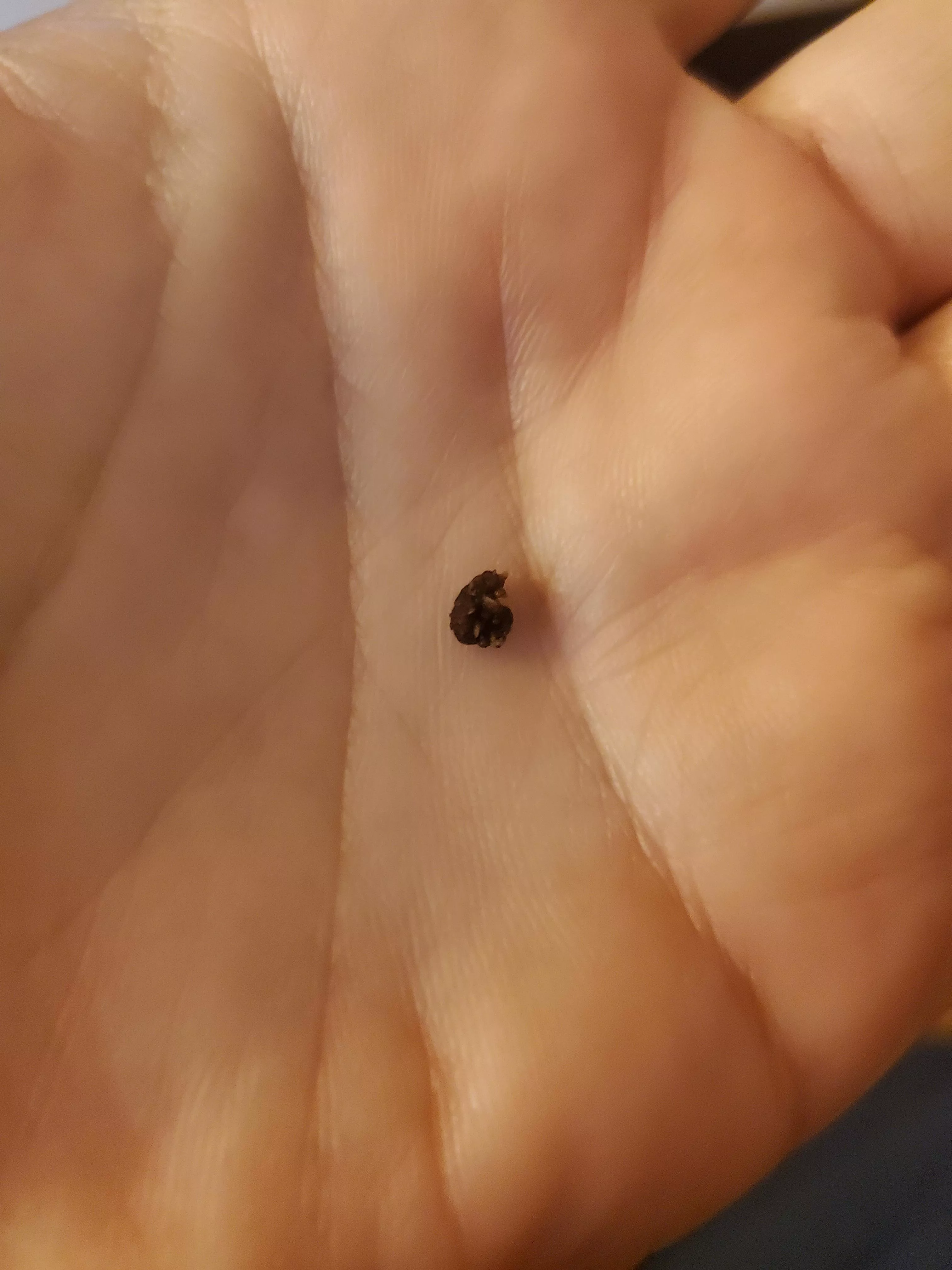 Wife popped this kidney stone out. Zoom in to see it's evil spikes