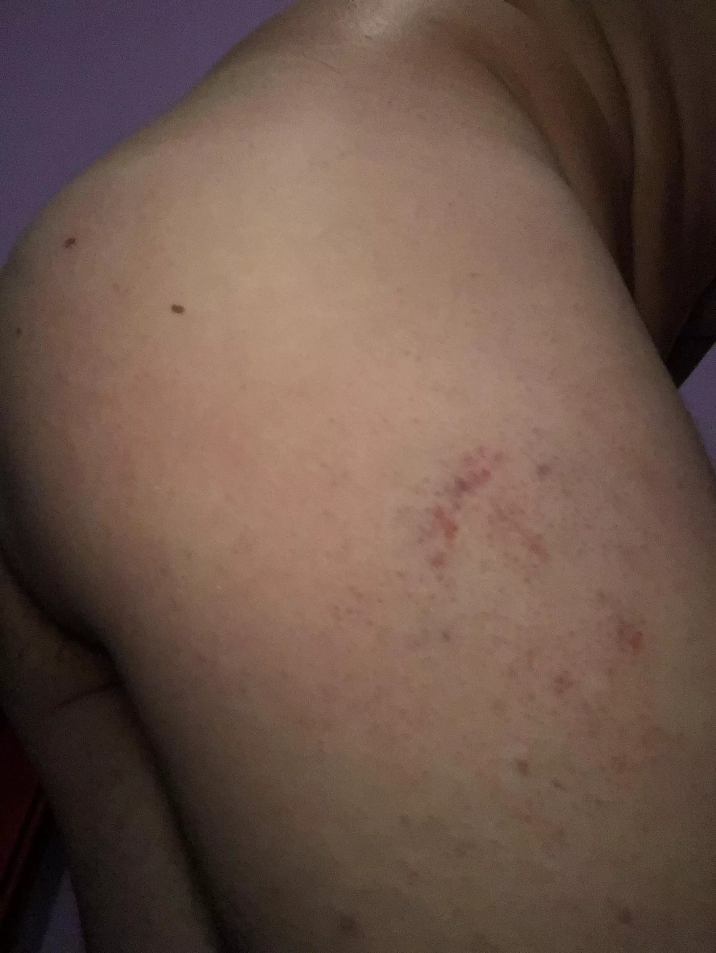 Woke up with a slightly bruised ass after a well-deserved whipping last night