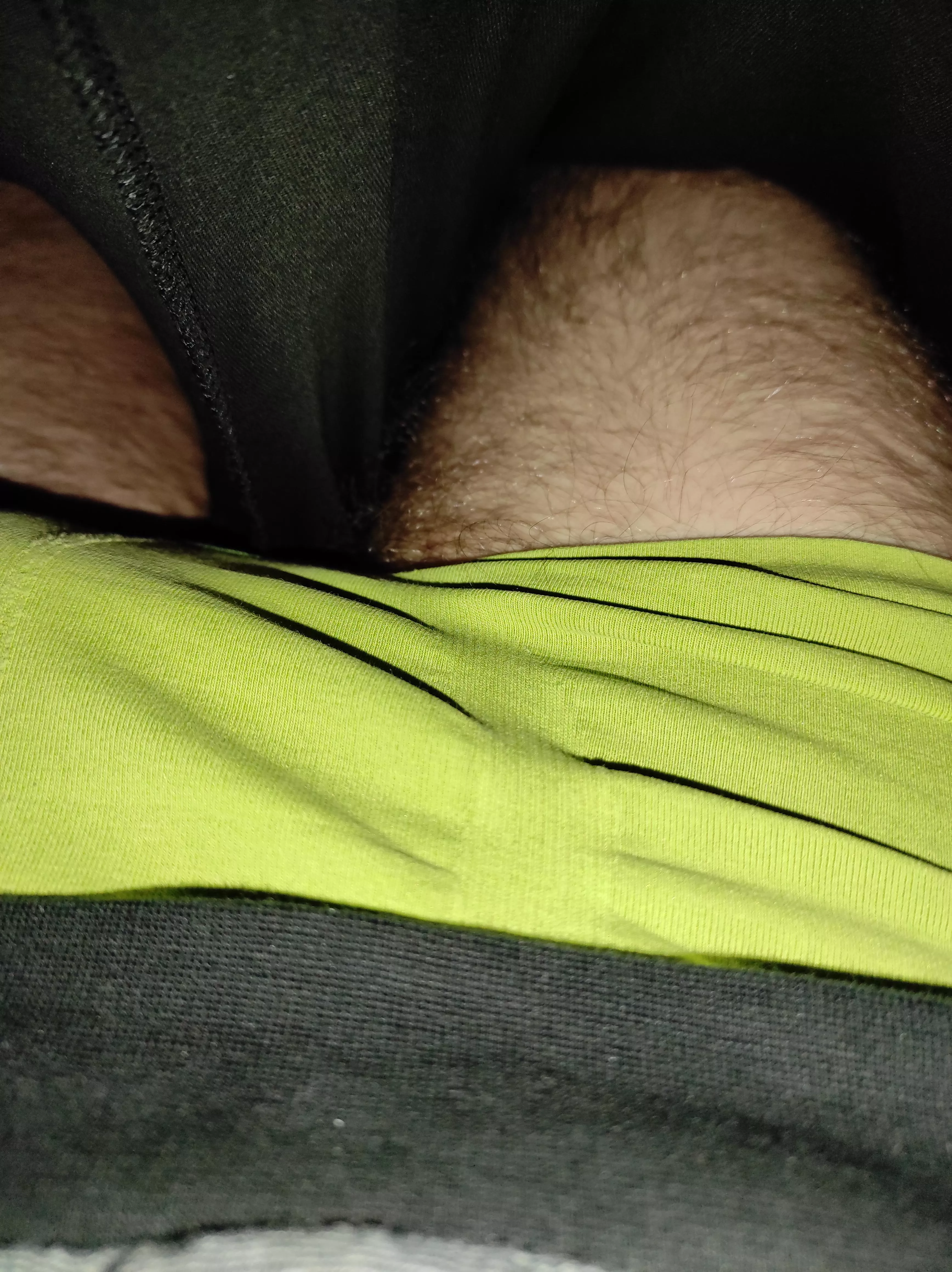 Would you have guessed that there is more hair under the green trunks?