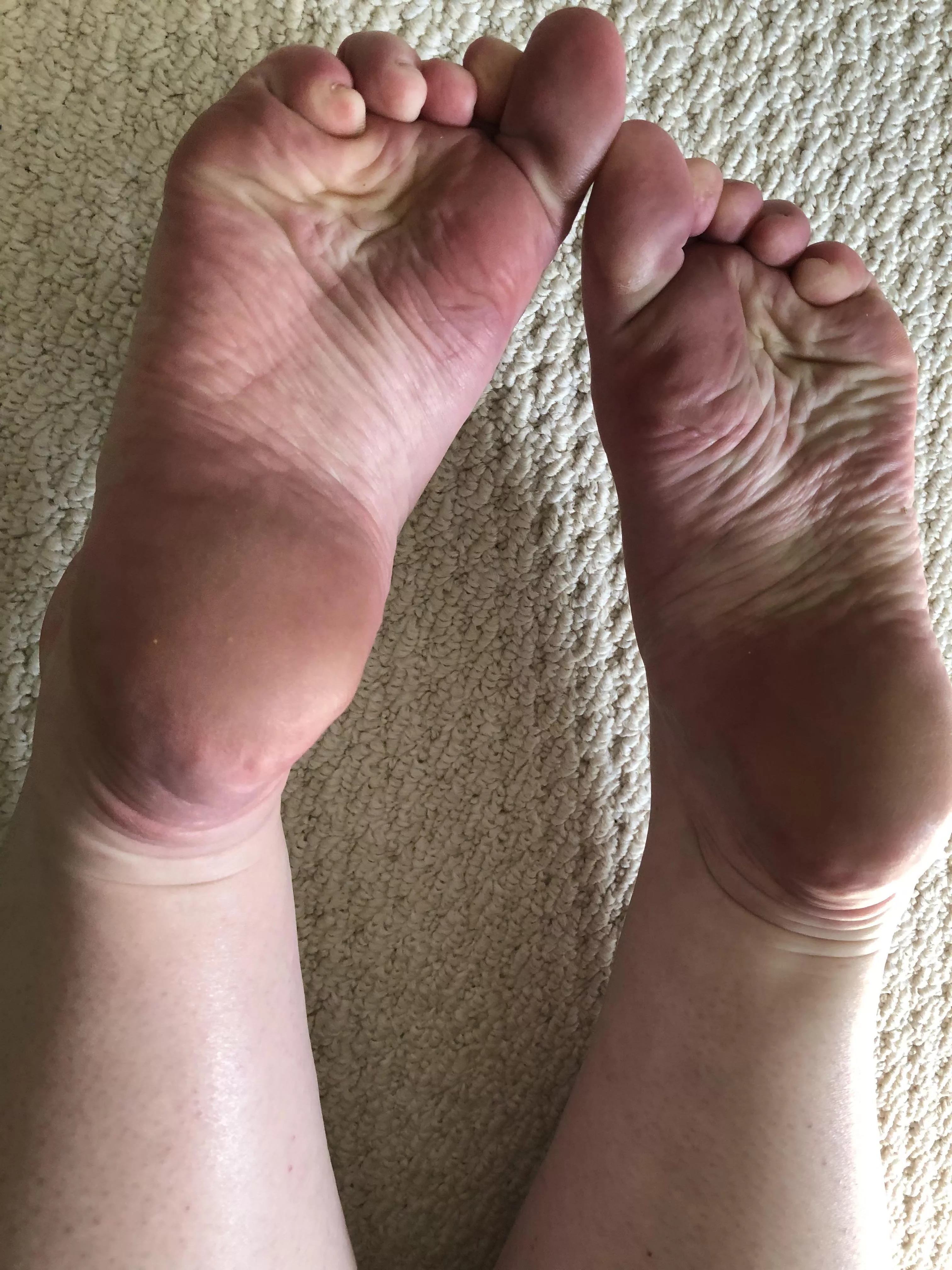 Wrinkled soles and stubby toes